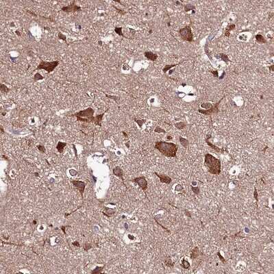 Immunohistochemistry-Paraffin: HYLS1 Antibody [NBP1-83513]