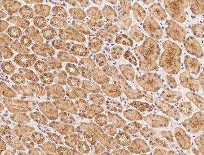Immunohistochemistry-Paraffin: HYLS1 Antibody [NBP3-12710]