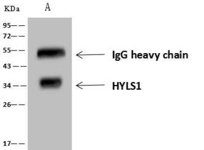 Immunoprecipitation: HYLS1 Antibody [NBP3-12710]
