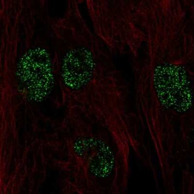 Immunocytochemistry/ Immunofluorescence: HYPE Antibody [NBP2-58855]