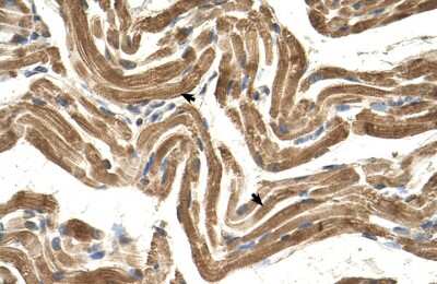 Immunohistochemistry-Paraffin: HYPE Antibody [NBP1-58290]