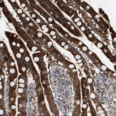 Immunohistochemistry-Paraffin: HYPE Antibody [NBP1-89697]