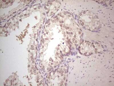 Immunohistochemistry: Hairless Antibody (OTI1D9) [NBP2-46004]