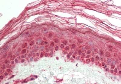 Immunohistochemistry-Paraffin: Hairless Antibody [NBP2-87553]