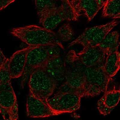 Immunocytochemistry/ Immunofluorescence: Haptoglobin Antibody [NBP2-48880]