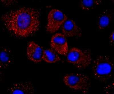 Immunocytochemistry/ Immunofluorescence: Haptoglobin Antibody (JM10-79) [NBP2-66881]