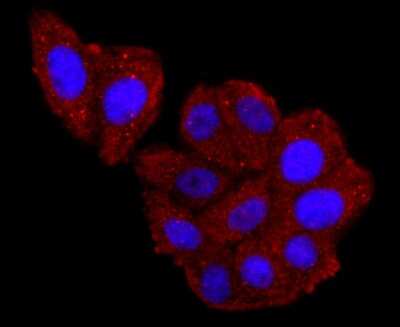 Immunocytochemistry/ Immunofluorescence: Haptoglobin Antibody (JM10-79) [NBP2-66881]
