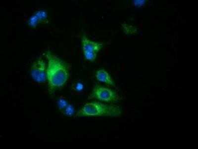 Immunocytochemistry/ Immunofluorescence: Haptoglobin Antibody (OTI4H5) - Azide and BSA Free [NBP2-70925]