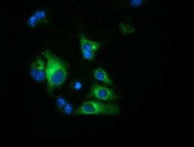 Immunocytochemistry/ Immunofluorescence: Haptoglobin Antibody (OTI4H5) [NBP2-03008]
