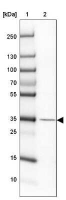 Western Blot: Haptoglobin Antibody [NBP2-48880]