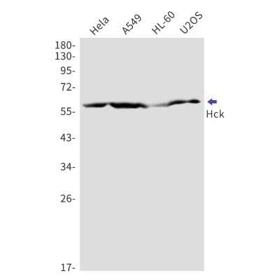 Western Blot: Hck Antibody (S02-5C1) [NBP3-14957]