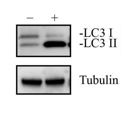 Western Blot: HeLa Chloroquine Treated / Untreated Cell Lysate [NBP2-49689]