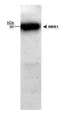 Western Blot: HeLa Whole Cell Lysate [NB800-PC1]