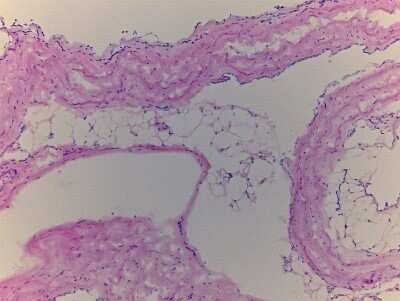 Hematoxylin & Eosin Stain: Heart Pericardium Tissue Slides (Adult Normal)- Frozen [NBP2-77550]