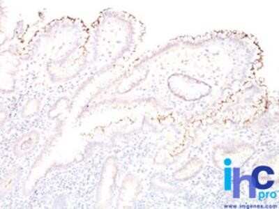 Immunohistochemistry-Paraffin: Helicobacter Pylori Antibody - Azide and BSA Free [NBP2-33100]