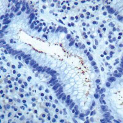 Immunohistochemistry-Paraffin: Helicobacter Pylori Antibody [NB120-7788]