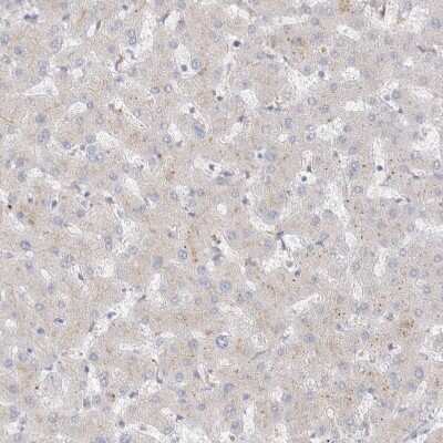 Immunohistochemistry: Hematopoietic Prostaglandin D Synthase/HPGDS Antibody [NBP1-83322]