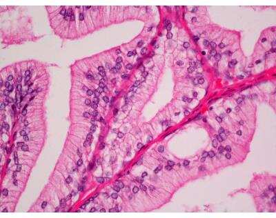 Immunohistochemistry: Hematoxylin and Eosin Stain Kit [H-3502-NB]