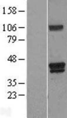 Western Blot: HO-2/HMOX2 Overexpression Lysate [NBP2-11387]