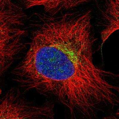 Immunocytochemistry/ Immunofluorescence: Hemicentin 2 Antibody [NBP2-30512]