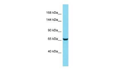 Western Blot: Hemicentin 2 Antibody [NBP3-09735]