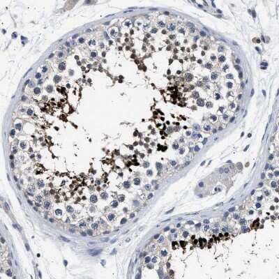 Immunohistochemistry-Paraffin: Hemogen Antibody [NBP1-84907]