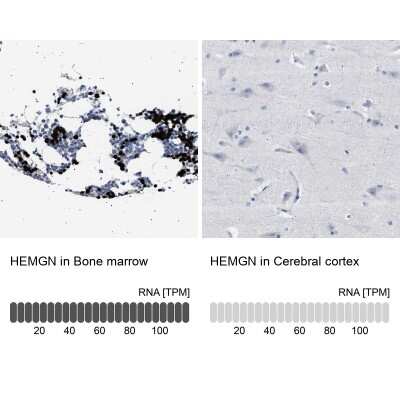 Immunohistochemistry-Paraffin: Hemogen Antibody [NBP1-84908]