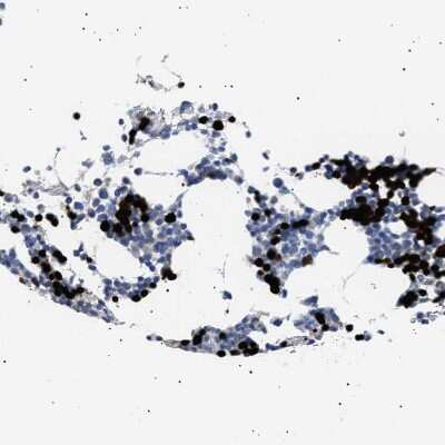 Immunohistochemistry-Paraffin: Hemogen Antibody [NBP1-84908]