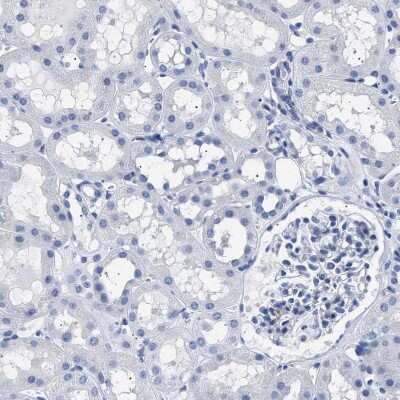 Immunohistochemistry-Paraffin: Hemogen Antibody [NBP1-84908]