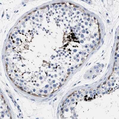 Immunohistochemistry-Paraffin: Hemogen Antibody [NBP1-84908]