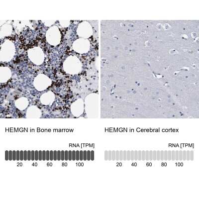 Immunohistochemistry-Paraffin: Hemogen Antibody [NBP1-84909]