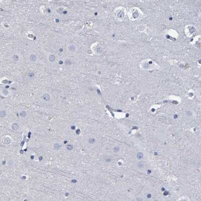 Immunohistochemistry-Paraffin: Hemogen Antibody [NBP1-84909]