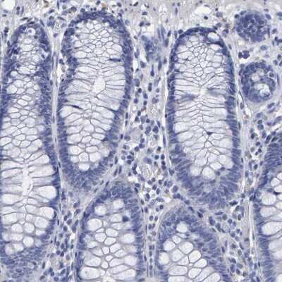 Immunohistochemistry-Paraffin: Hemogen Antibody [NBP1-84909]
