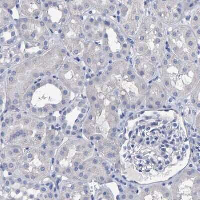 Immunohistochemistry-Paraffin: Hemogen Antibody [NBP1-84909]