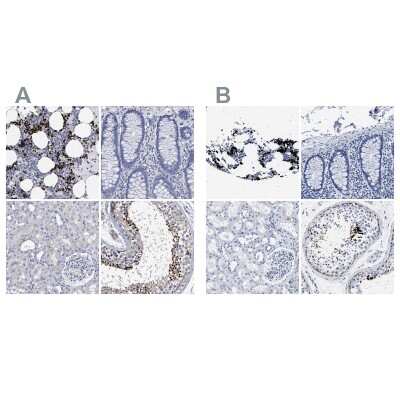 Immunohistochemistry-Paraffin: Hemogen Antibody [NBP1-84909]
