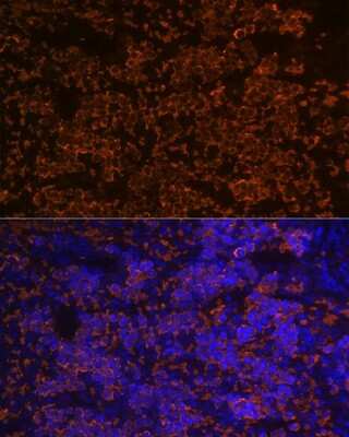 Immunohistochemistry: Hemoglobin A1 Antibody (1R1N7) [NBP3-16804]