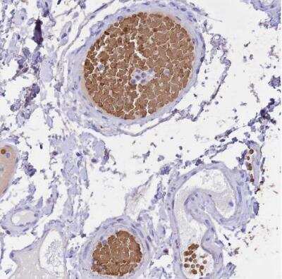 Immunohistochemistry-Paraffin: Hemoglobin A1 Antibody [NBP2-54711]