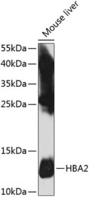 Western Blot: Hemoglobin A2 AntibodyBSA Free [NBP3-05569]