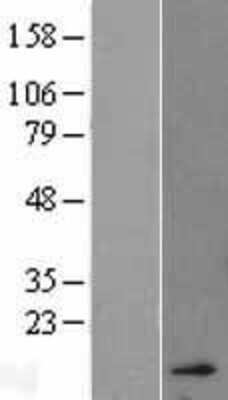 Western Blot: Hemoglobin A2 Overexpression Lysate [NBL1-11455]