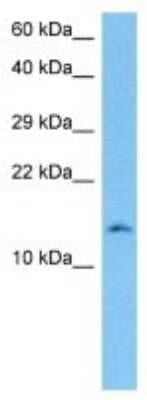 Western Blot: Hemoglobin beta 2 Antibody [NBP3-10143]