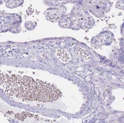 Immunohistochemistry-Paraffin: Hemoglobin beta Antibody [NBP2-14081]