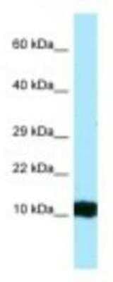 Western Blot: HBG1/2 Antibody [NBP1-98291]
