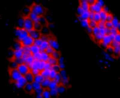 Immunocytochemistry/ Immunofluorescence: HBG1/2 Antibody (JM84-10) [NBP2-66885]