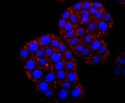 Immunocytochemistry/ Immunofluorescence: HBG1/2 Antibody (JM84-10) [NBP2-66885]