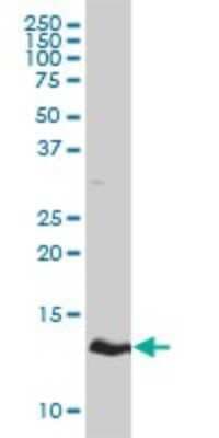Western Blot: Hemoglobin zeta Antibody (3C4-1D5) [H00003050-M01]