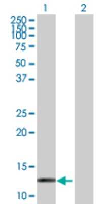 Western Blot: Hemoglobin zeta Antibody [H00003050-D01P]