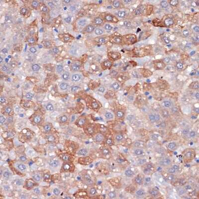 Immunohistochemistry-Paraffin: Hemopexin Antibody (1M6O3) [NBP3-16762]