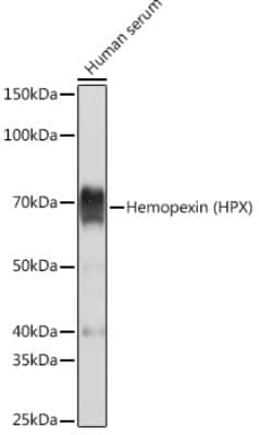 Western Blot: Hemopexin Antibody (1M6O3) [NBP3-16762]