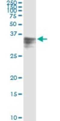 Immunoprecipitation: Hemopexin Antibody (3A9-1A9) [H00003263-M01]