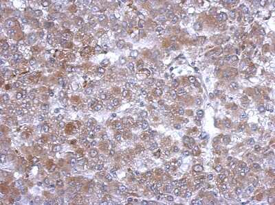 Immunohistochemistry-Paraffin: Hemopexin Antibody [NBP2-16807]